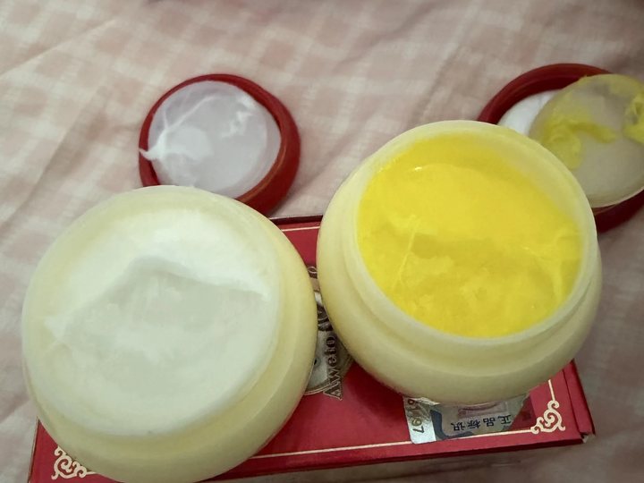 Buyer photo of Aweto Day & Night Cream Set